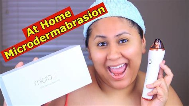 Top At-Home Microdermabrasion Kits of 2023 – Hollywood Life Reviews – Hollywood Life