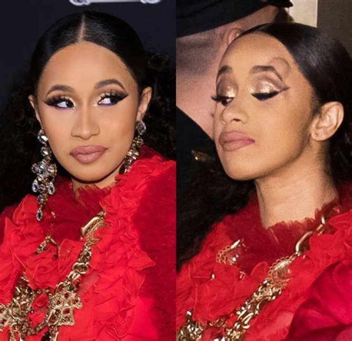 Cardi B Shows Off Huge Bump On Her Head After Nicki Minaj Fight — Pic – Hollywood Life